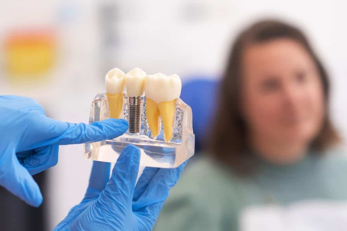 5 Ways Dental Implants Justify the Investment