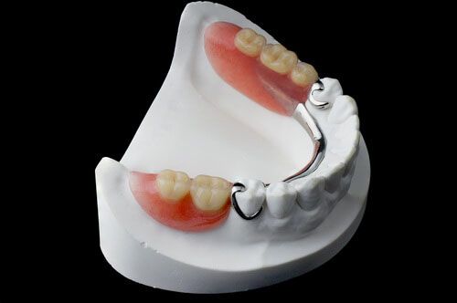 Partial Dentures Wantirna South