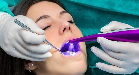 dental sealants wantirna south