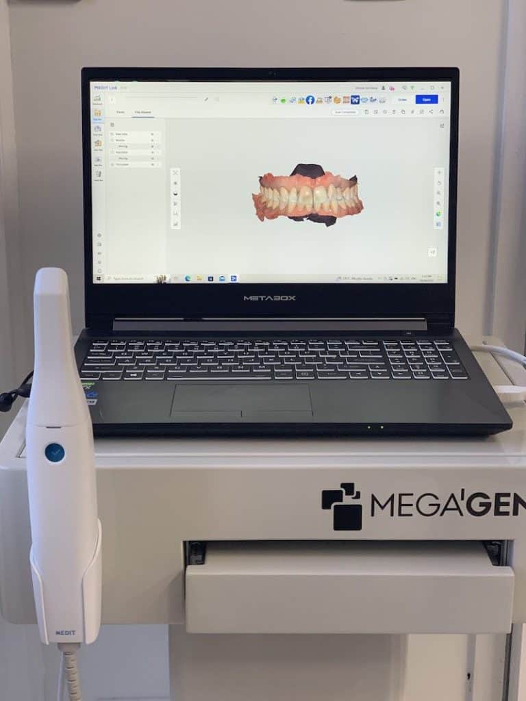 medit i500 intraoral scanner